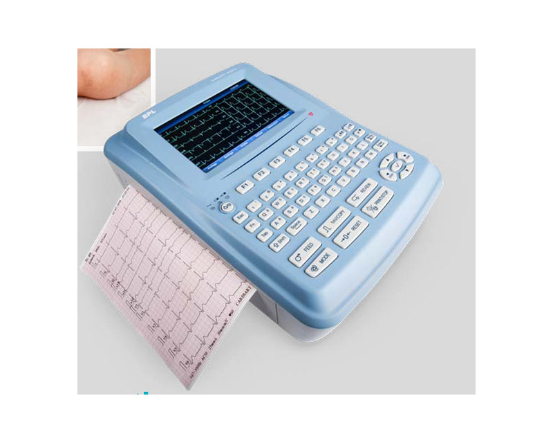 ECG Patient Monitoring & Diognostics